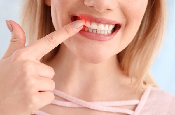 Paradentose er tandkødsbetændelse